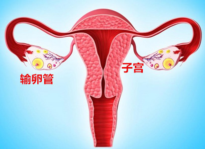 输卵管堵塞如何复通？输卵管堵塞怎么才能治好