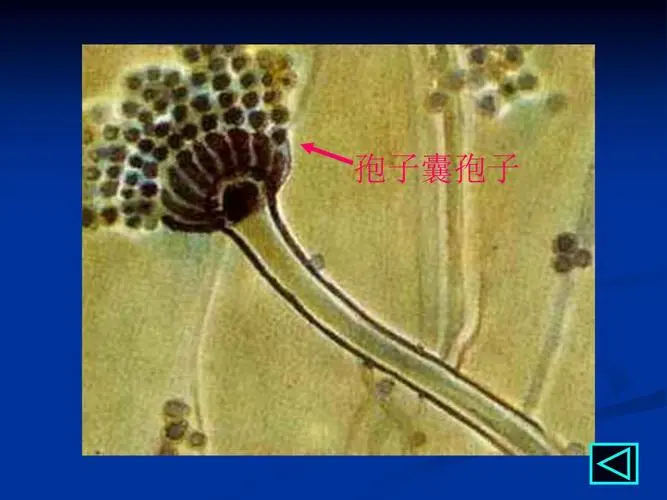 检查出现芽生孢子是什么意思？芽生孢子代表什么？