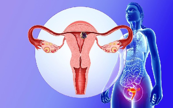 子宫畸形导致不孕不育怎么治疗？子宫畸形手术费用是多少？