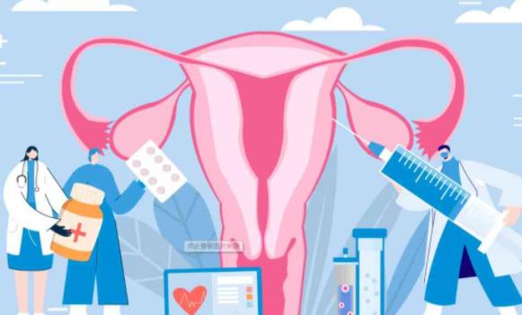 什么是多囊卵巢综合征？诊断标准和诊疗过程以及如何备孕？
