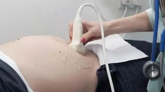 为什么人们倾向于去俄罗斯做试管婴儿？俄罗斯试管囊胚移植技术介绍